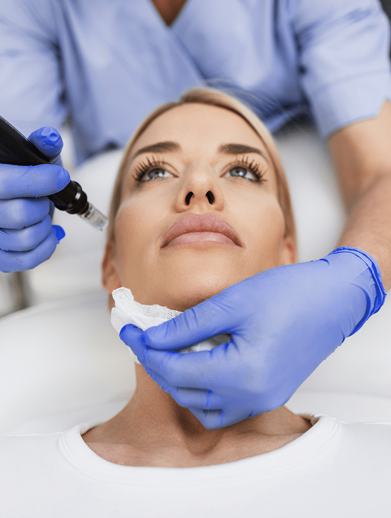 Woman lying down with microneedling pen