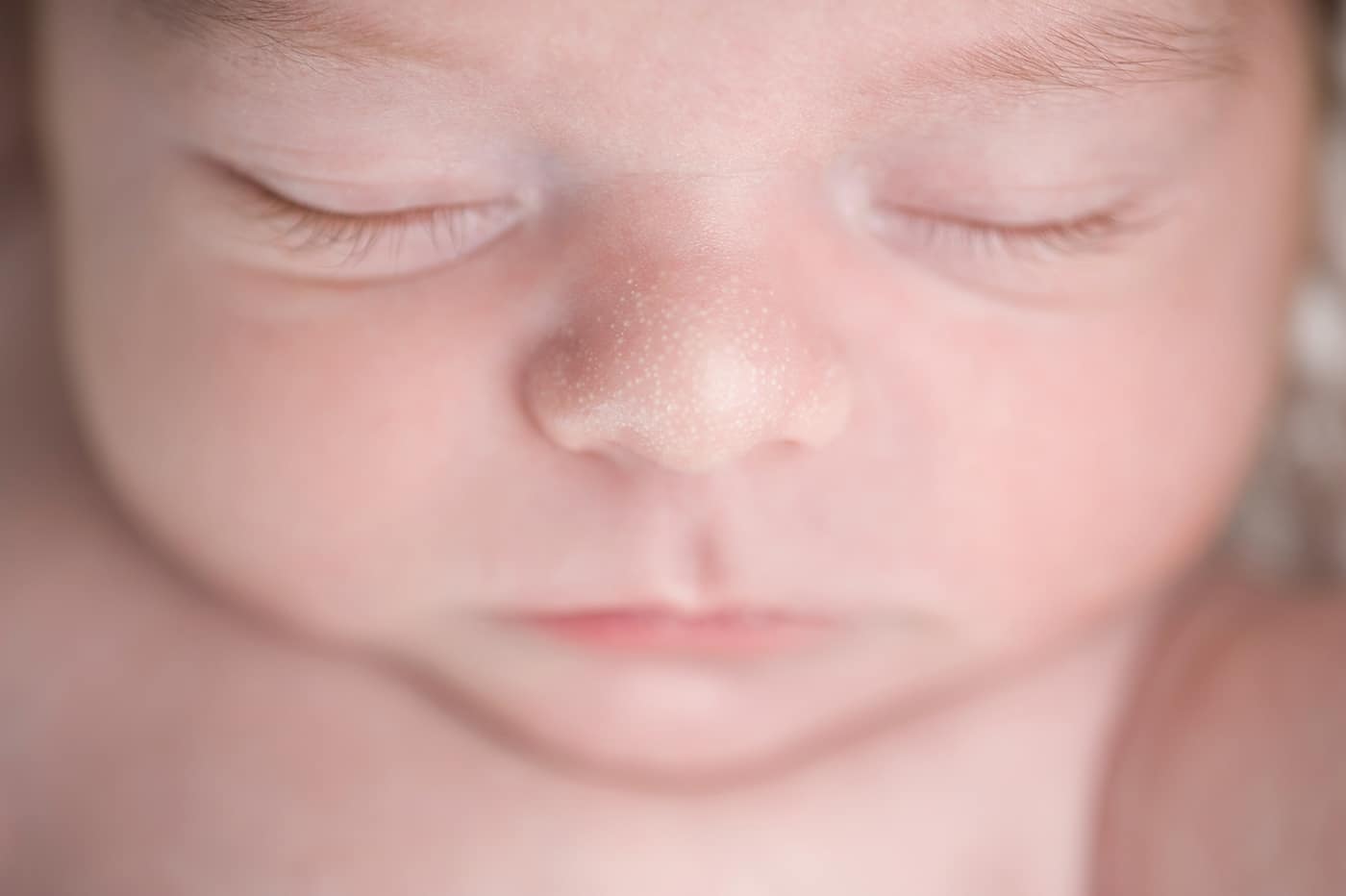 An overhead, close-up shot of the milia on a three week old baby boy's nose.
