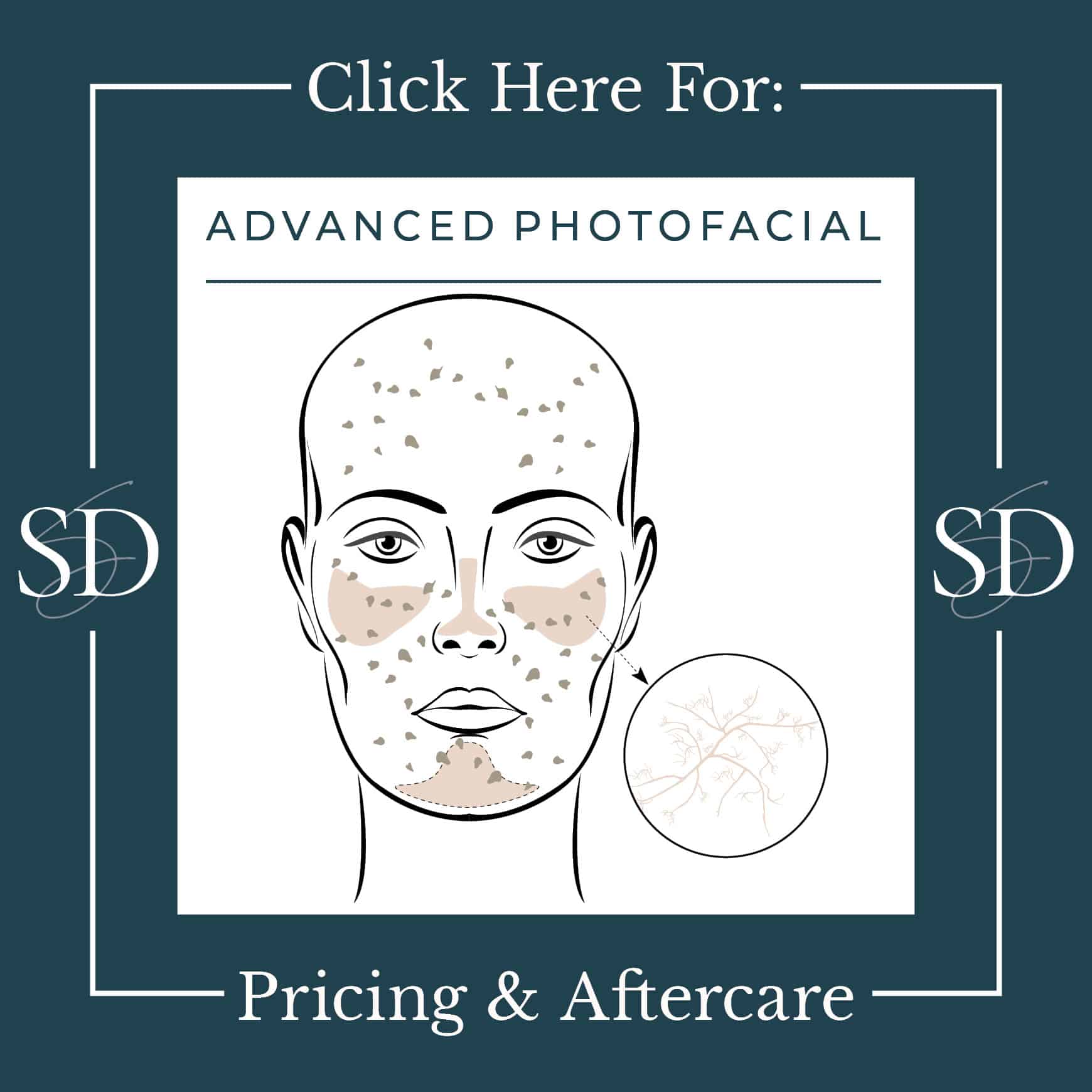 Advanced Photofacial pricing and treatment details.