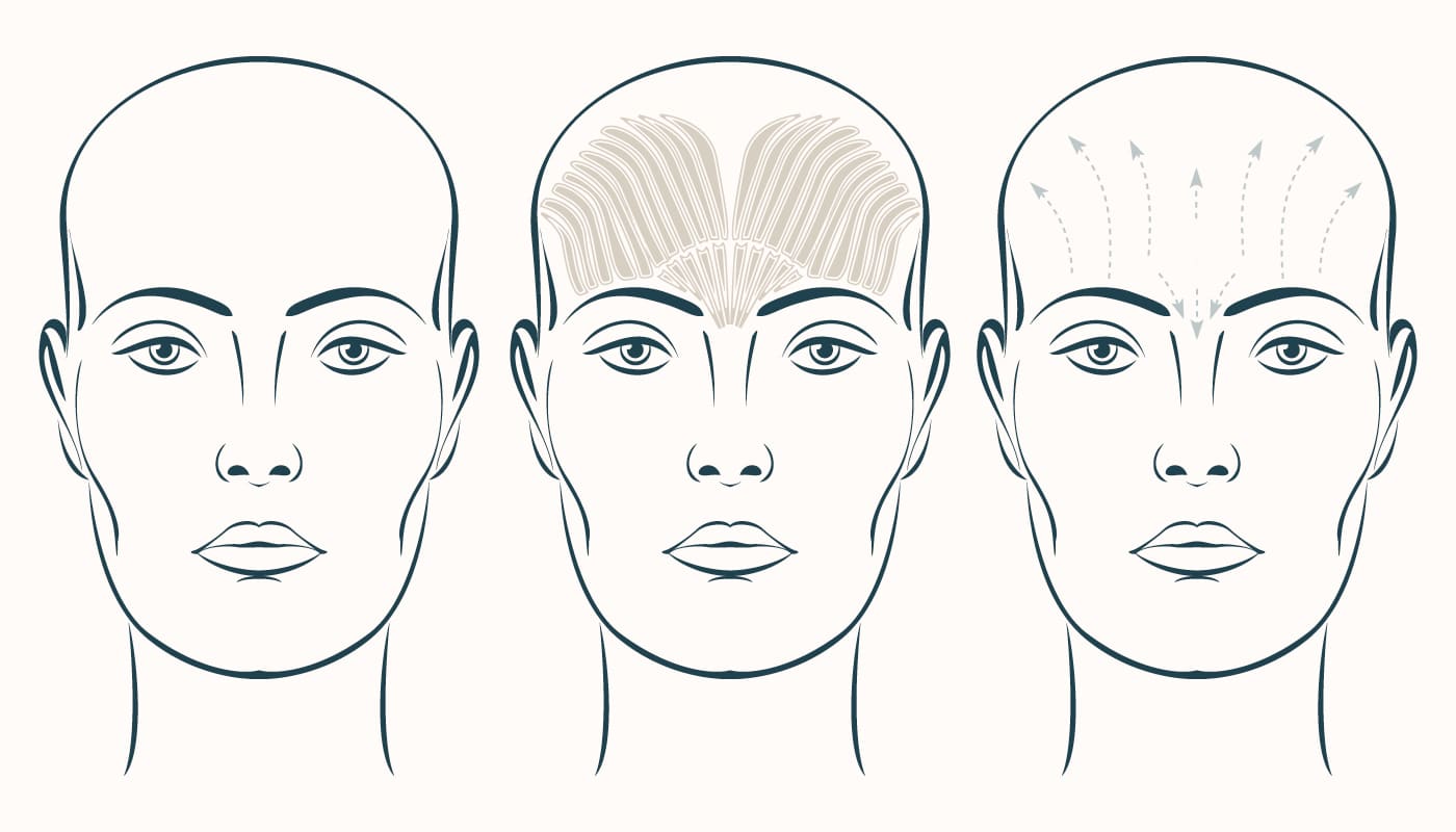 Botox facial muscle movements