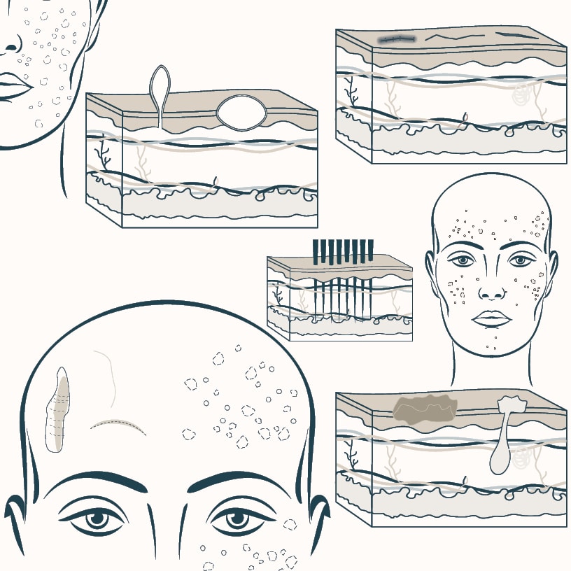 Pigmentation and discoloration cosmetic treatments