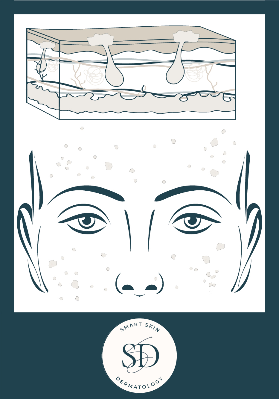 types of acne