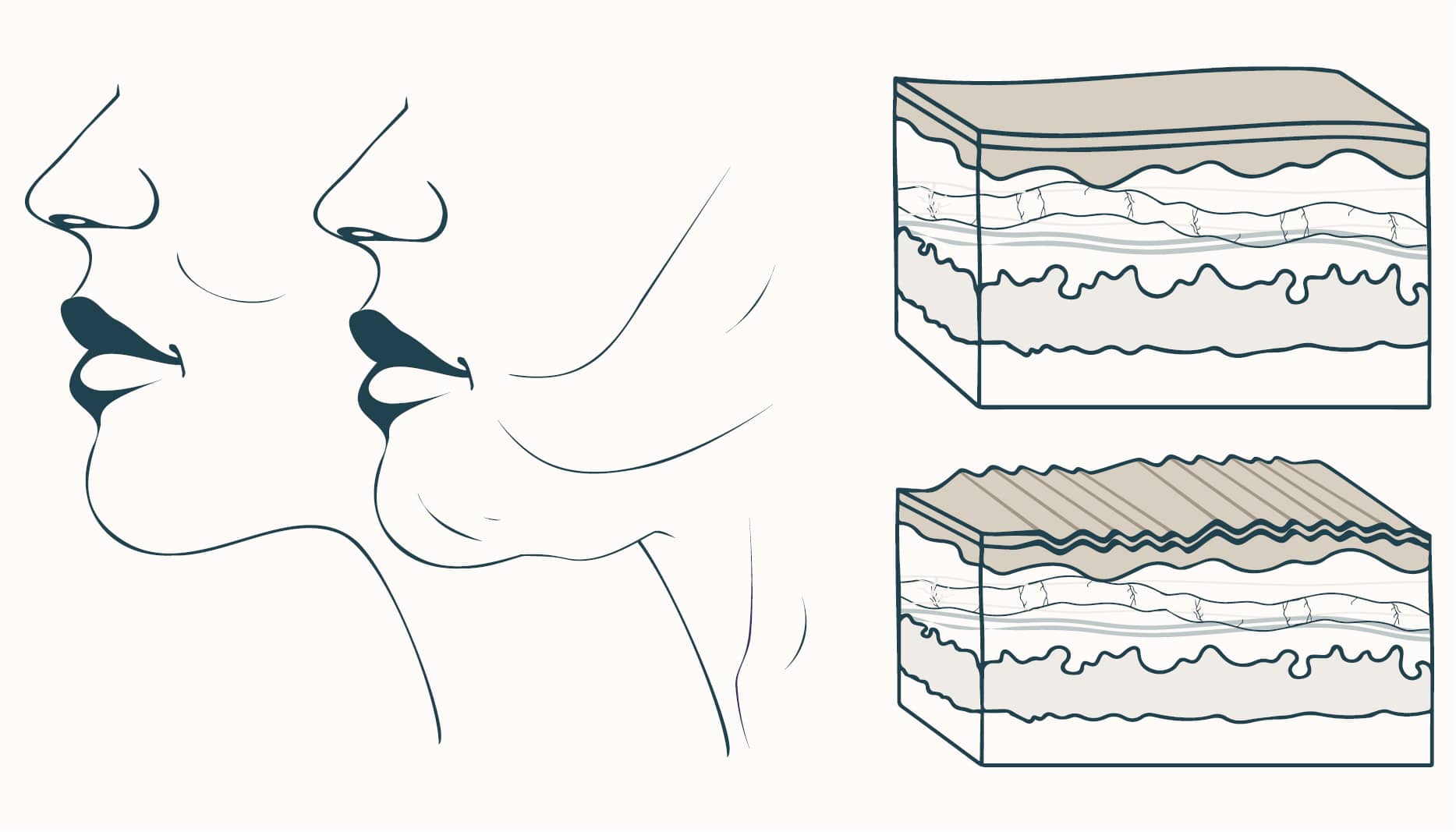loose skin appearing on the face causing drooping