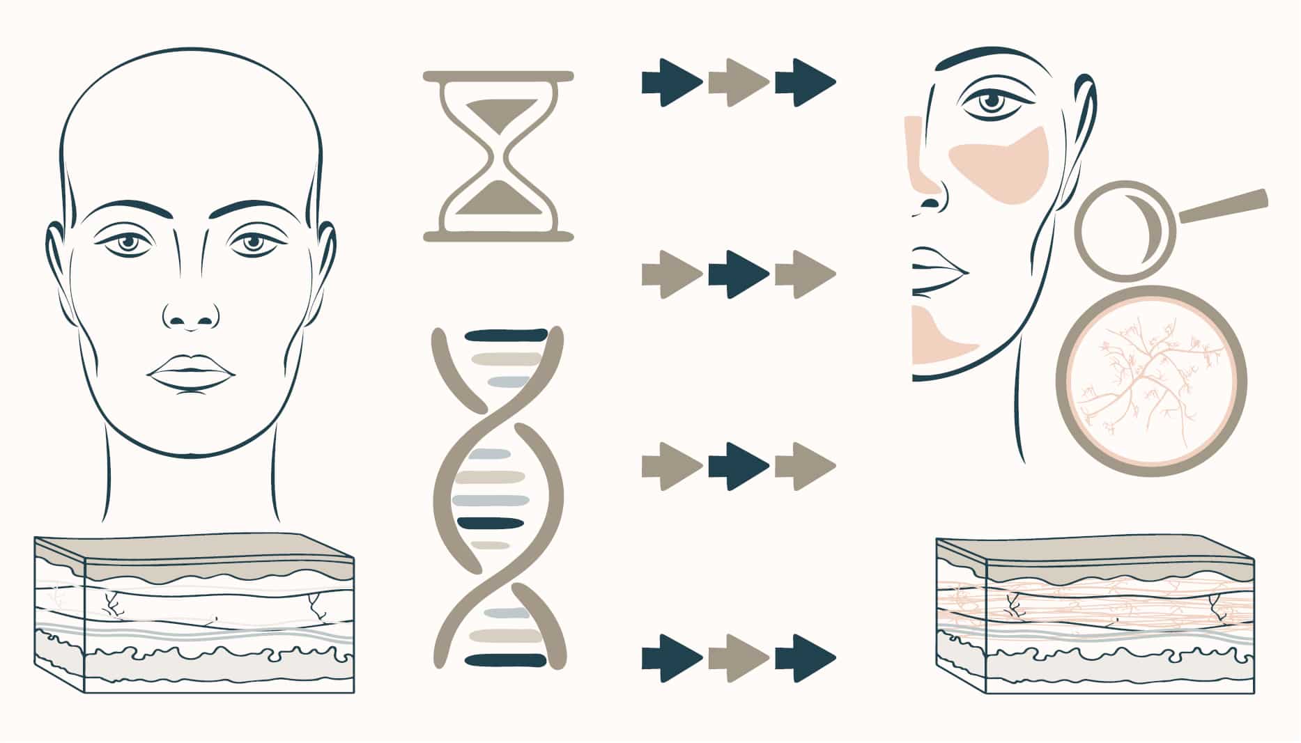 Rosacea occurring over time