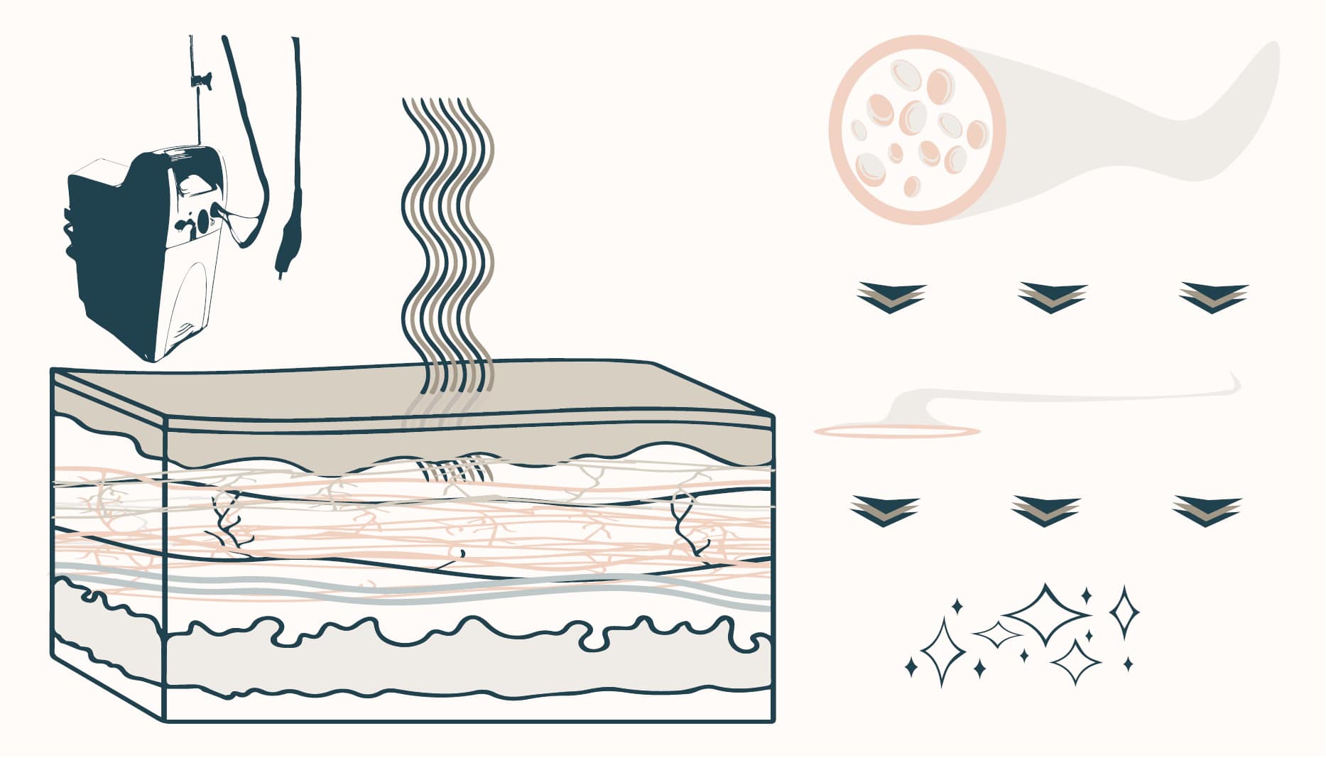 how a vbeam laser pulse enters the skin