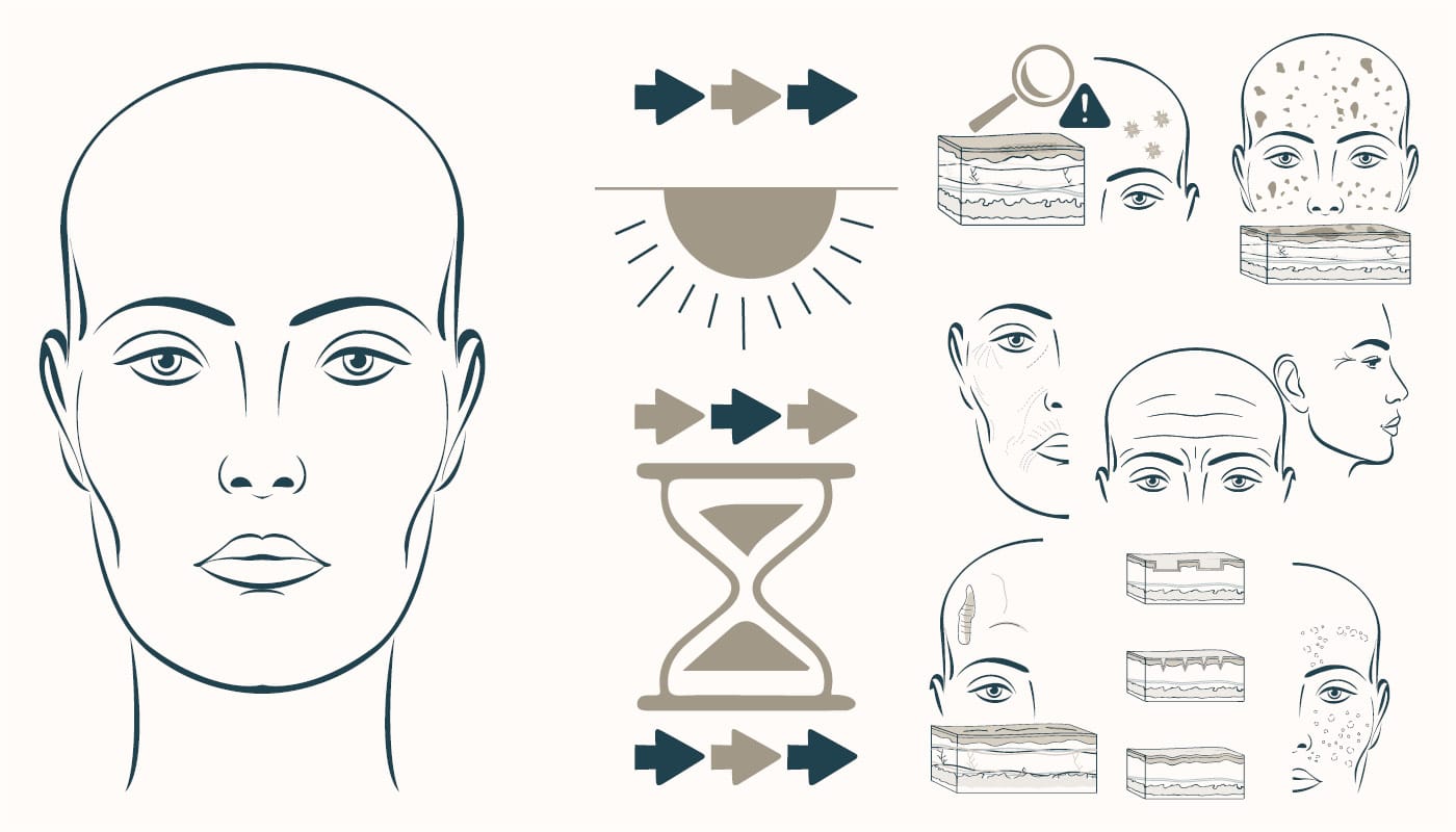 aging diagram sun damage, wrinkles, and scarring