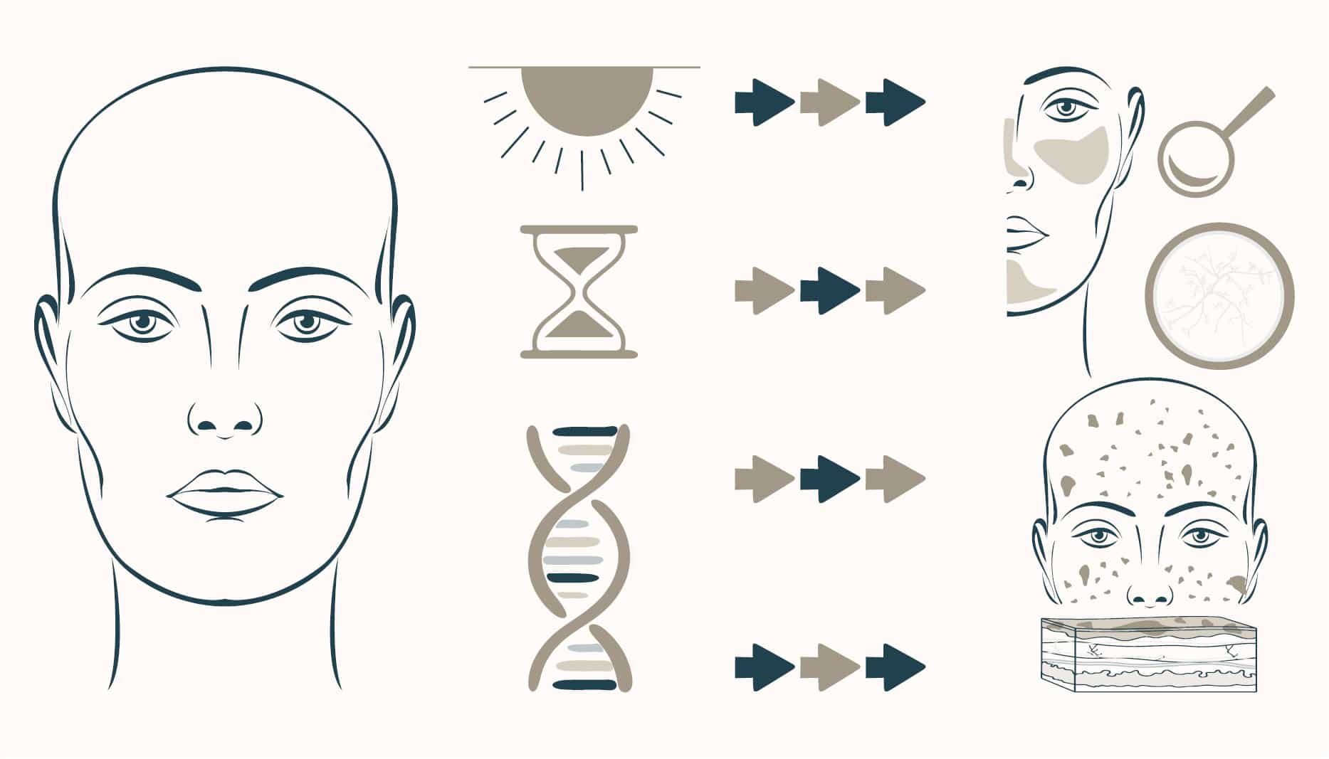 aging, dna, and sun cause blood vessels and brown pigment