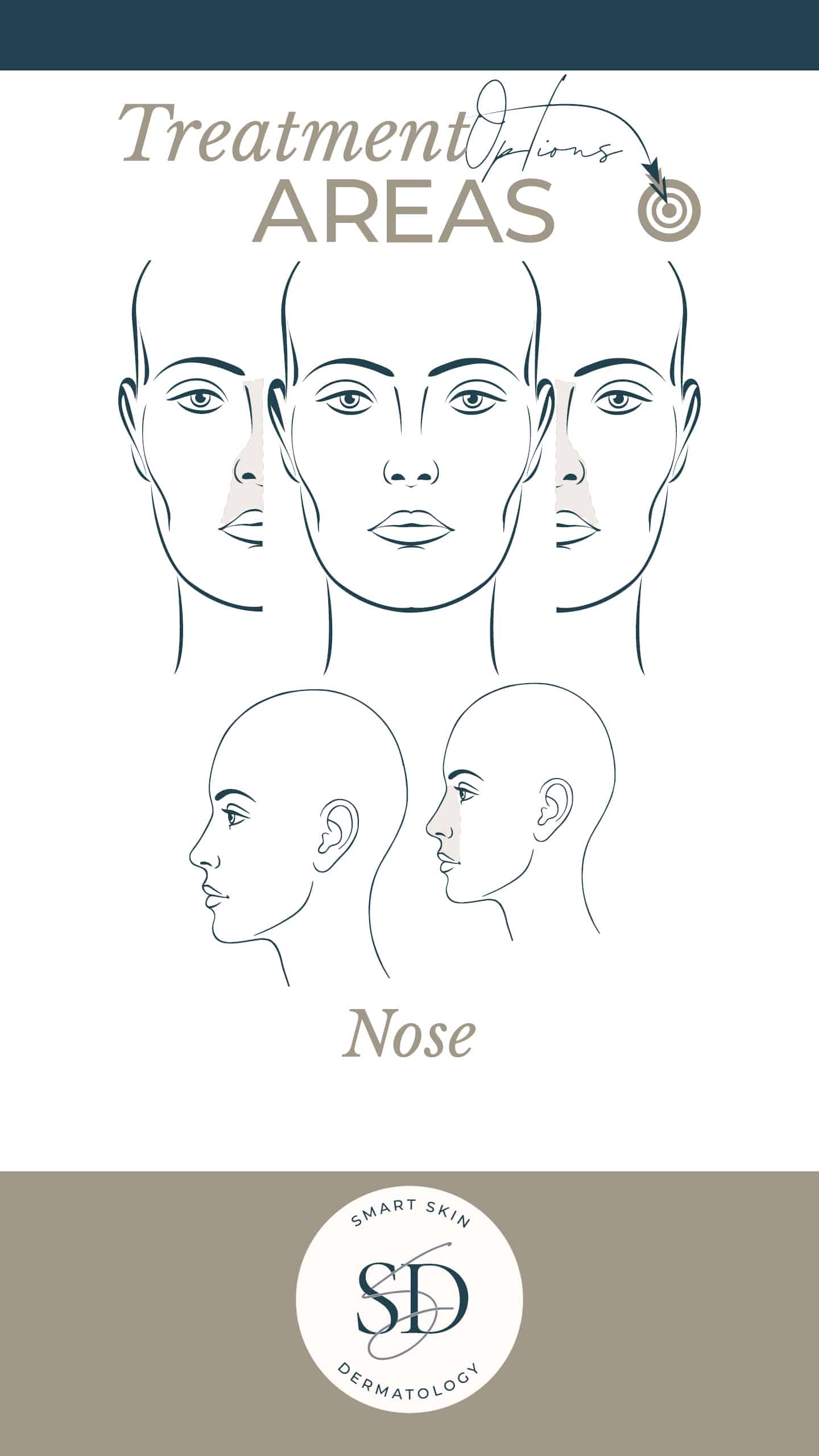 Nose