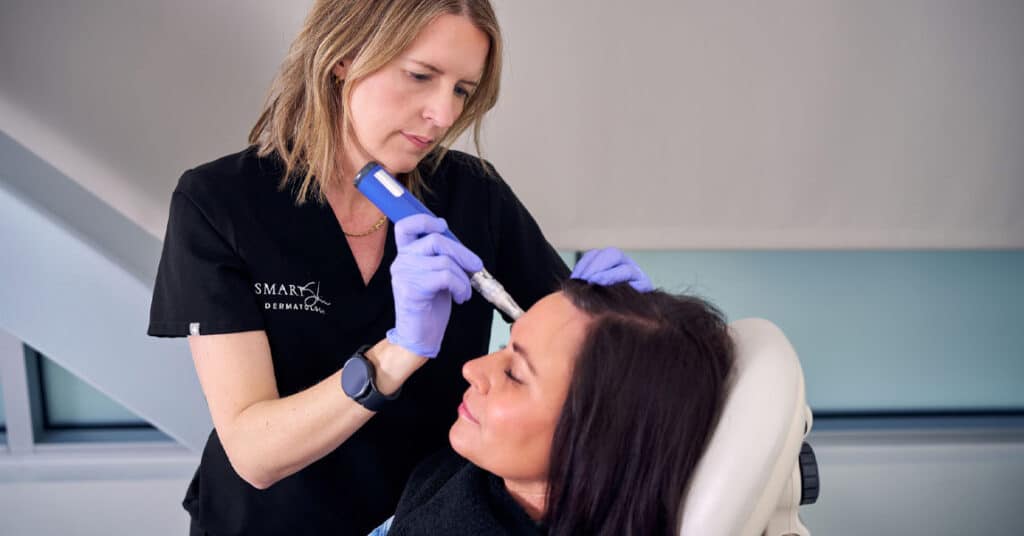 Woman receiving a microneedling treatment at Smart Skin Dermatology