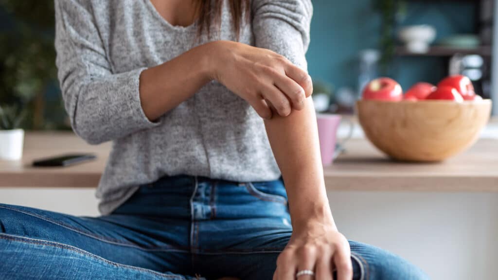 Woman experiencing itching from contact dermatitis on her arm