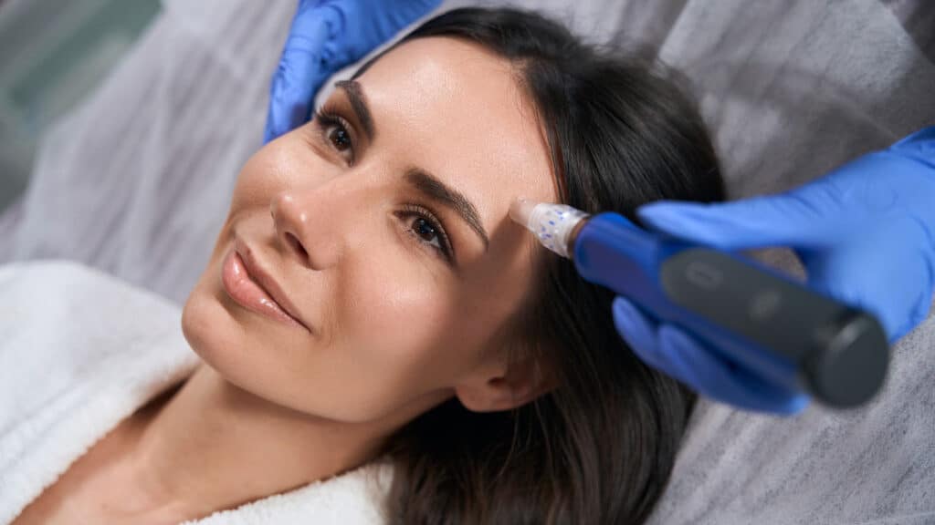 Microneedling treatment performed by a dermatologist as part of skin rejuvenation procedures discussed in what is exosomes treatment
