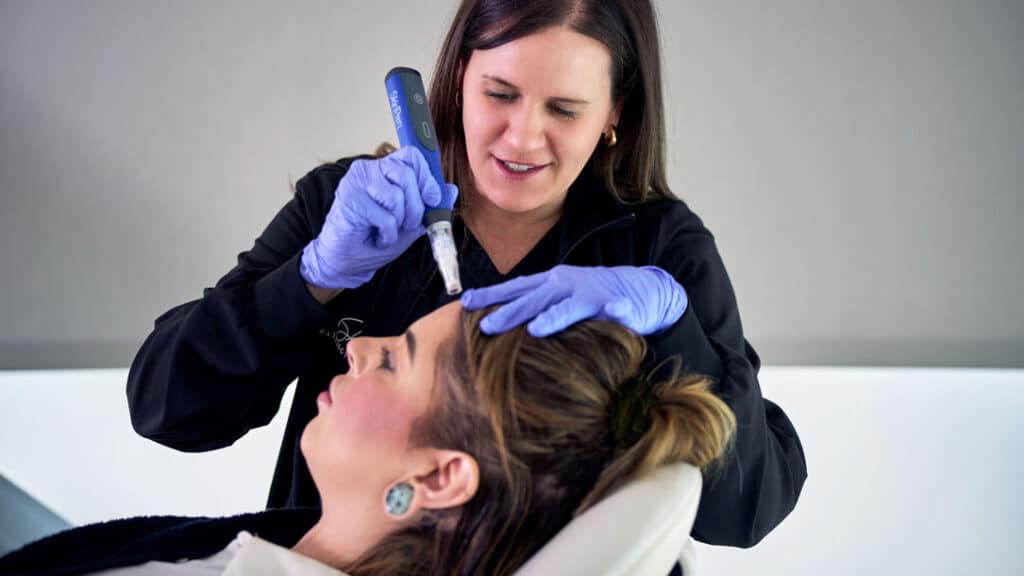 Patient receiving microneedling treatment to help restore collagen in the face and improve skin texture