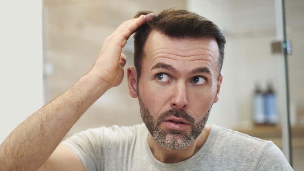 Man checking his scalp in the mirror for signs of seborrheic dermatitis and hair thinning